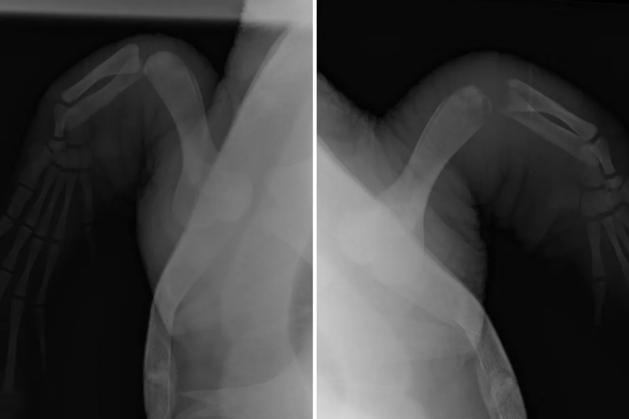 Nobomvu X rays